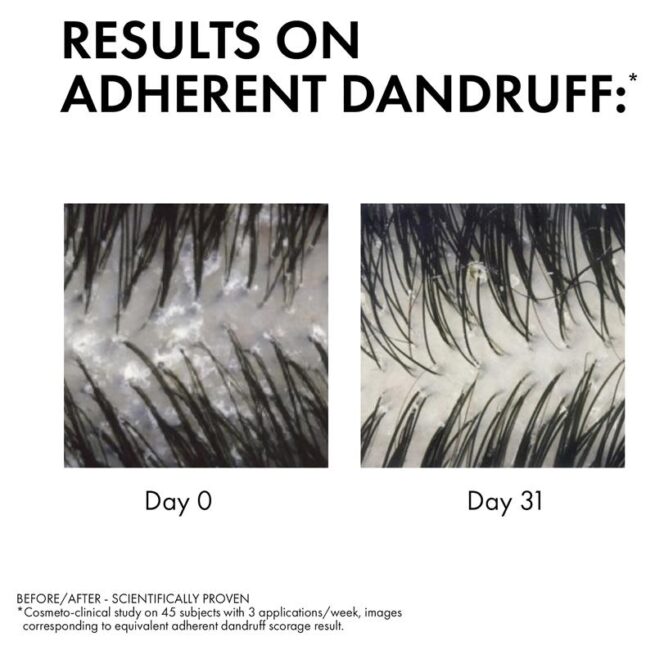 Dercos Anti-Dandruff DS Shampoo for Normal to Oily Hair 200mL